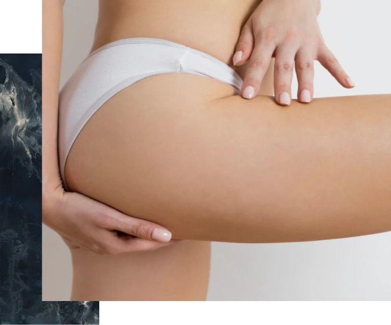 What to Expect After a Thigh Lift in Scottsdale, Arizona Banner